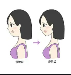 乳房缩小前，做这三个简单步骤，轻松让你恢复自信！